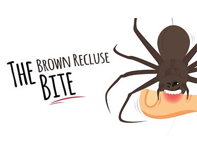 Illustration titled 'The Brown Recluse Bite' showing a cartoon brown recluse spider biting a person's skin.