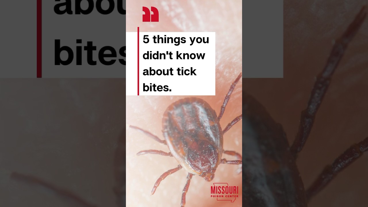 tick walking on human skin 5 things you didn't know about tick bites